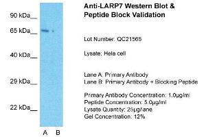 Host: Rabbit  Target Name: LARP7  Sample Tissue: Hela Whole cell  Lane A:  Primary Antibody Lane B:  Primary Antibody + Blocking Peptide Primary Antibody Concentration: 1 µg/mL Peptide Concentration: 5 µg/mL Lysate Quantity: 41 µg/laneGel Concentration:. (LARP7 anticorps  (C-Term))