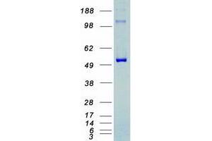 Validation with Western Blot