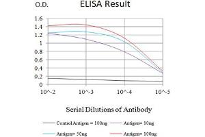 Black line: Control Antigen (100 ng),Purple line: Antigen (10 ng), Blue line: Antigen (50 ng), Red line:Antigen (100 ng)