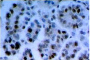 Immunohistochemistry (IHC) image for anti-RAD17 (RAD17) antibody (ABIN492574) (RAD17 anticorps)