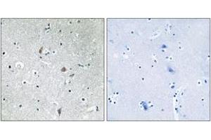 Immunohistochemistry analysis of paraffin-embedded human brain, using mTOR (Phospho-Ser2448) Antibody. (MTOR anticorps  (pSer2448))