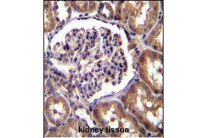 TLL2 Antibody (N-term) (ABIN392519 and ABIN2842079) immunohistochemistry analysis in formalin fixed and paraffin embedded human kidney tissue followed by peroxidase conjugation of the secondary antibody and DAB staining.