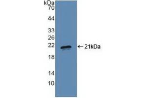 Detection of Recombinant PRDM1, Human using Polyclonal Antibody to PR Domain Containing Protein 1 (PRDM1) (PRDM1 anticorps  (AA 29-149))
