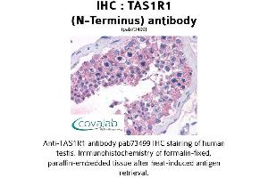 Image no. 1 for anti-Taste Receptor, Type 1, Member 1 (TAS1R1) (Extracellular Domain), (N-Term) antibody (ABIN1739915) (TAS1R1 anticorps  (Extracellular Domain, N-Term))