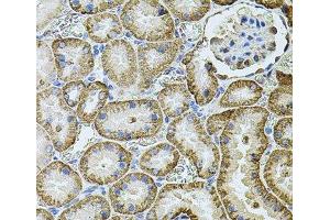 Immunohistochemistry of paraffin-embedded Rat kidney using CDH16 Polyclonal Antibody at dilution of 1:100 (40x lens). (Cadherin-16 anticorps)
