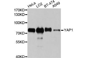 Western blot analysis of extracts of various cell lines, using YAP1 antibody (ABIN5970389) at 1/1000 dilution. (YAP1 anticorps)