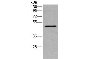 Western blot analysis of Human placenta tissue lysate using TRDMT1 Polyclonal Antibody at dilution of 1:300 (Dnmt2 anticorps)