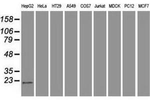 Western blot analysis of extracts (35 µg) from 9 different cell lines by using anti-AK1 monoclonal antibody. (Adenylate Kinase 1 anticorps)