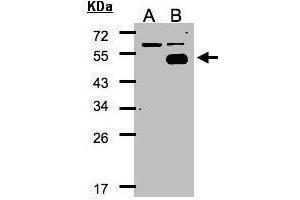 WB Image Western Blot analysis of NR2F1 expression in transfected 293T cell line by NR2F1 polyclonal antibody. (NR2F1 anticorps  (N-Term))