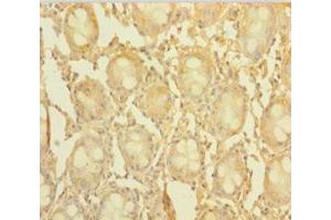 Immunohistochemistry of paraffin-embedded human colon tissue using ABIN7148176 at dilution of 1:100 (CCDC94 anticorps  (AA 1-279))