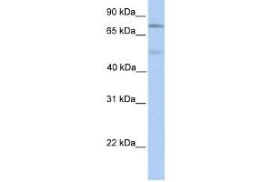 WB Suggested Anti-SP1 Antibody Titration:  0. (SP1 anticorps  (Middle Region))