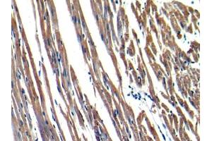 DAB staining on IHC-P; Samples: Rat Heart Tissue