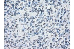 Image no. 4 for anti-Crystallin, alpha B (CRYAB) antibody (ABIN1497647)