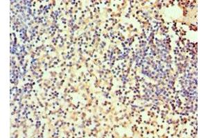 Immunohistochemistry of paraffin-embedded human spleen tissue using ABIN7146696 at dilution of 1:100