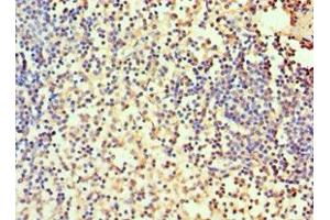 Immunohistochemistry of paraffin-embedded human spleen tissue using ABIN7146696 at dilution of 1:100 (CA1 anticorps  (AA 1-261))