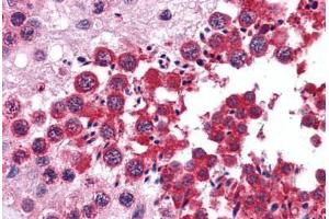 Human Testis: Formalin-Fixed, Paraffin-Embedded (FFPE)