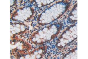 IHC-P analysis of Human Tissue, with DAB staining. (CDX2 anticorps  (AA 1-313))
