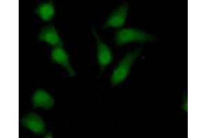 Detection of SULF2 in Human HepG2 Cells using Polyclonal Antibody to Sulfatase 2 (SULF2)