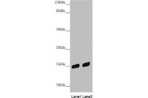 Western blot All lanes: PSPH antibody at 3. (PSPH anticorps  (AA 1-225))