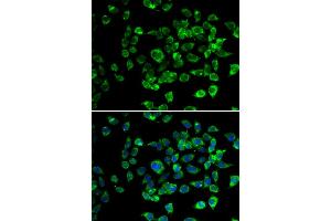 Immunofluorescence analysis of U2OS cells using PSMD13 antibody. (PSMD13 anticorps)