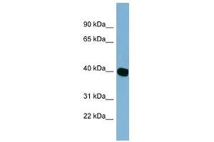 C14ORF148 antibody used at 1 ug/ml to detect target protein. (NOXRED1 anticorps  (Middle Region))