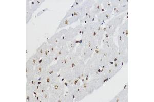 Immunohistochemistry of paraffin-embedded rat heart using Acetyl-Histone H3-K27 antibody (ABIN7267670) at dilution of 1:200 (40x lens).