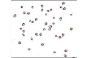 Immunocytochemistry of NOD2 in Jurkat cells with this product at 5 μg/ml.