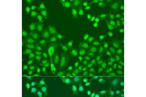 Immunofluorescence analysis of U2OS cells using CTCF Polyclonal Antibody at dilution of 1:100.
