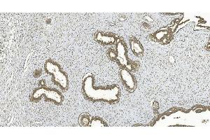 IHC analysis of ERK5/MAPK7 using anti-ERK5/MAPK7 antibody (ABIN7600701). (MAPK7 anticorps  (AA 22-816))