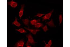 ABIN6266829 staining HepG2 by IF/ICC.