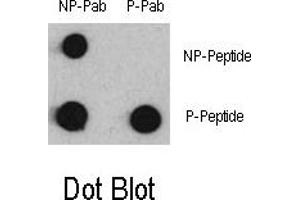 Image no. 1 for anti-Myocyte Enhancer Factor 2C (MEF2C) (pSer387) antibody (ABIN358336) (MEF2C anticorps  (pSer387))