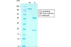 SDS-PAGE Analysis Purified Glypican-3 Mouse Recombinant Monoclonal Ab (rGPC3/863). (Recombinant Glypican 3 anticorps)