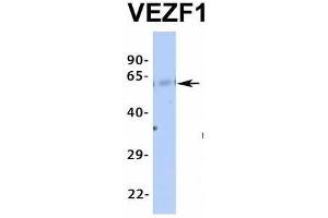 Host:  Rabbit  Target Name:  VEZF1  Sample Type:  Human Fetal Liver  Antibody Dilution:  1.