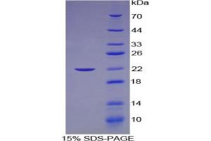 SDS-PAGE analysis of Human Laminin gamma 2 Protein. (LAMC2 Protéine)