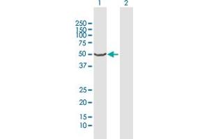 Western Blot analysis of CYP2A13 expression in transfected 293T cell line by CYP2A13 MaxPab polyclonal antibody.
