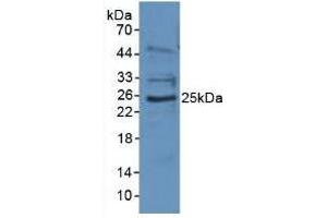 Rabbit Detection antibody from the kit in WB with Positive Control: Sample Human Jurkat Cells. (EBI3 Kit CLIA)