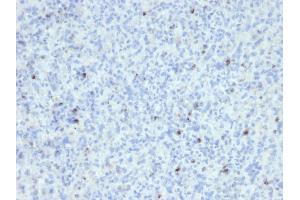 Formalin-fixed, paraffin-embedded human Spleen stained with Perforin Mouse Monoclonal Antibody (SPM434). (Perforin 1 anticorps  (AA 413-552))