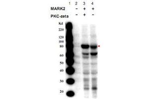 Western blot using MARK2 (phospho T595) polyclonal antibody  shows detection of a band at ~82 kDa corresponding to phosphorylated MARK2 (arrowhead). (MARK2 anticorps  (pThr595))