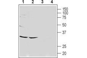 Western blot analysis of rat (lanes 1 and 3) and mouse (lanes 2 and 4) brain lysates: - 1,2. (CACNG7 anticorps  (1st Extracellular Loop))