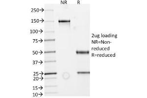 SDS-PAGE Analysis Purified IgA Secretory Component Mouse Monoclonal Antibody (ECM1/792).