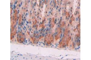 Used in DAB staining on fromalin fixed paraffin- embedded stomach tissue