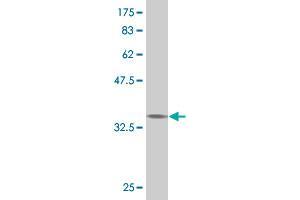 Western Blot detection against Immunogen (37.