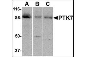 Western blot analysis of PTK7 in (A) human colon, (B) mouse kidney and (C) rat liver tissue lysate with this product at 1 μg/ml. (PTK7 anticorps  (C-Term))