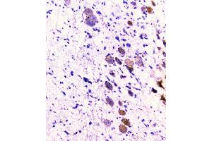 IHC analysis of CD2AP using anti-CD2AP antibody (ABIN6719544). (CD2AP anticorps  (AA 253-337))