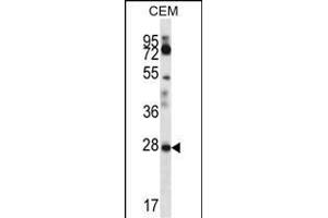 RARRES1 Antibody (C-term) (ABIN657062 and ABIN2846226) western blot analysis in CEM cell line lysates (35 μg/lane). (RARRES1 anticorps  (C-Term))