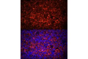 Immunofluorescence analysis of rat spleen using TLR8 Polyclonal Antibody (ABIN3022014, ABIN3022015, ABIN3022016, ABIN1513616 and ABIN6218568) at dilution of 1:100 (40x lens).