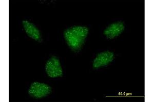 Immunofluorescence of purified MaxPab antibody to R3HDM2 on HeLa cell. (R3HDM2 anticorps  (AA 1-637))