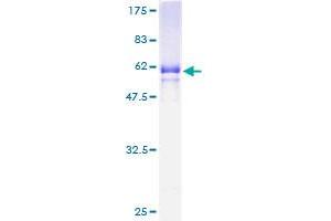 Image no. 1 for Antigen P97 (Melanoma Associated) Identified By Monoclonal Antibodies 133.2 and 96.5 (MFI2) (AA 21-302) protein (GST tag) (ABIN1310799)