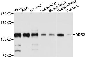 Western blot analysis of extracts of various cell lines, using DDR2 antibody (ABIN4903459) at 1:1000 dilution. (DDR2 anticorps)