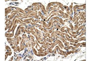 Immunohistochemistry (IHC) image for anti-ATP Synthase, H+ Transporting, Mitochondrial F1 Complex, beta Polypeptide (ATP5B) (N-Term) antibody (ABIN310995) (ATP5B anticorps  (N-Term))